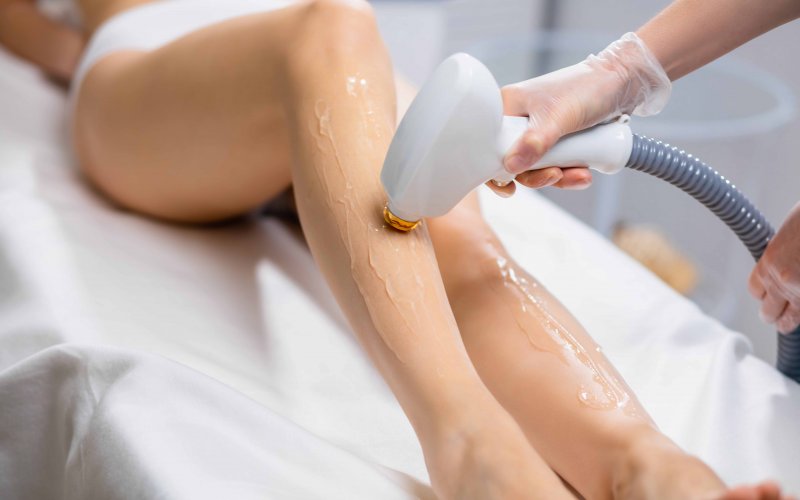 Lazer Epilasyon Nedir? Nasıl Yapılır? Kimler İçin Uygundur?